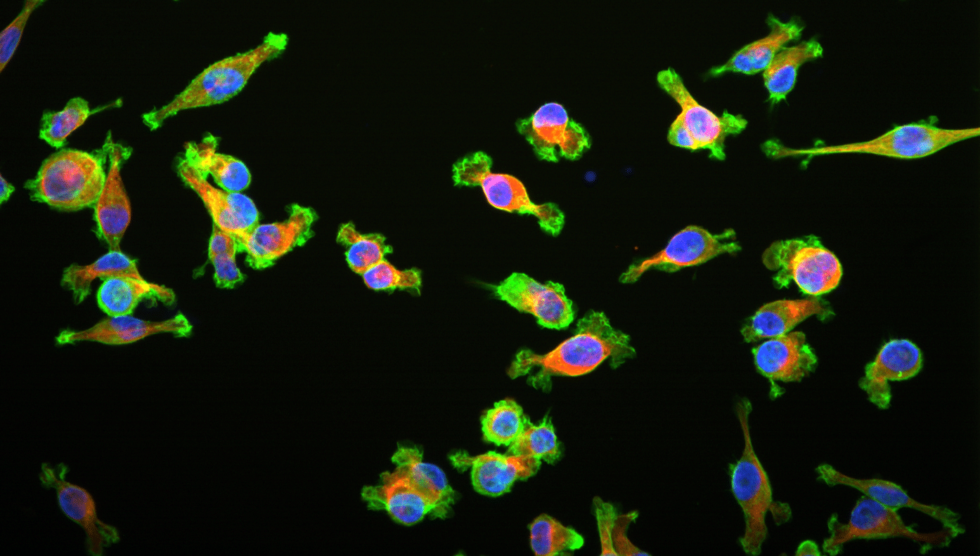 Morphological changes in breast cancer cells