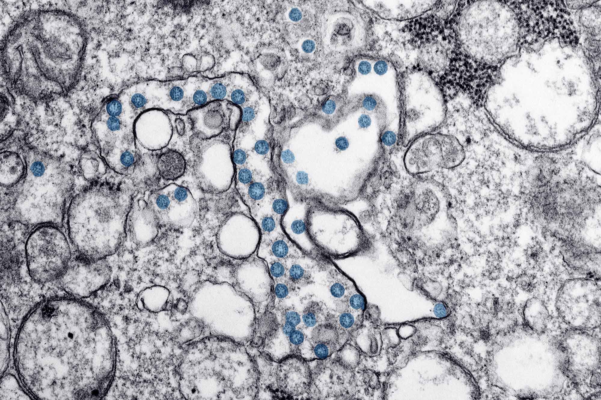 Isolate from the first U.S. case of COVID-19