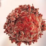 Leukaemia white blood cells, 3D illustration. Cancer cells