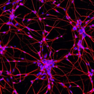 motor neurons grown from stem cells using complex developmental biology techniques (differentiated these cells from induced pluripotent stem cells/iPSCs (not embryonic stem cells)). In blue is the centre of each cell (the nucleus), and in red is the main structural component of each cell (the cytoskeleton).