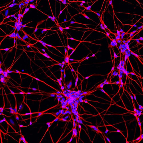 Motor neurons grown from stem cells using complex developmental biology techniques (differentiated these cells from induced pluripotent stem cells/iPSCs (not embryonic stem cells)). In blue is the centre of each cell (the nucleus), and in red is the main structural component of each cell (the cytoskeleton).