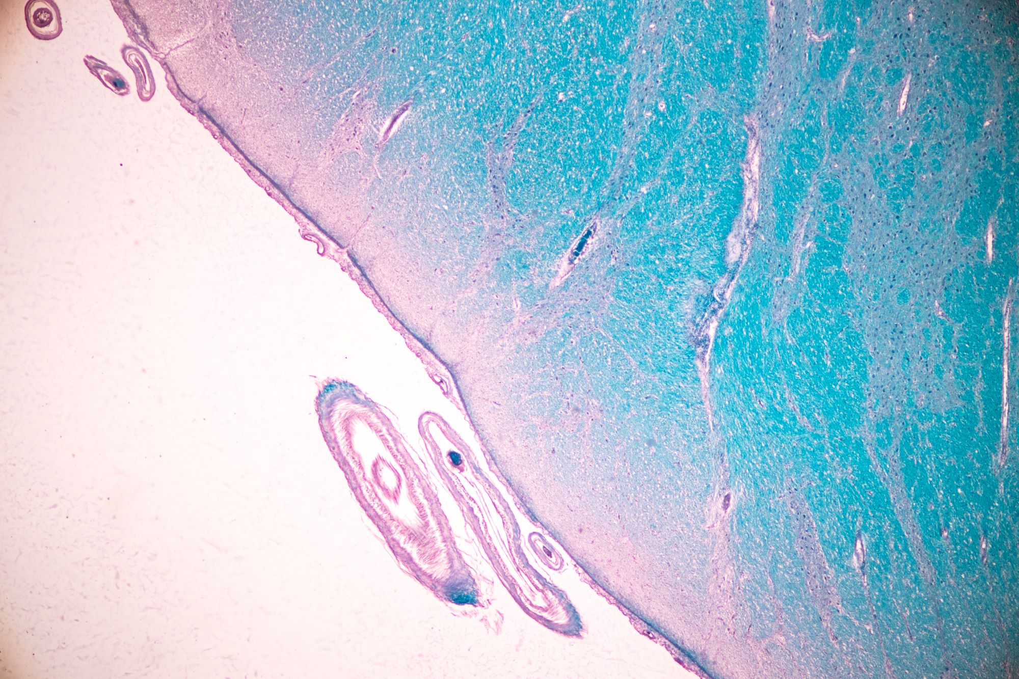 Microscope image of brain tissue