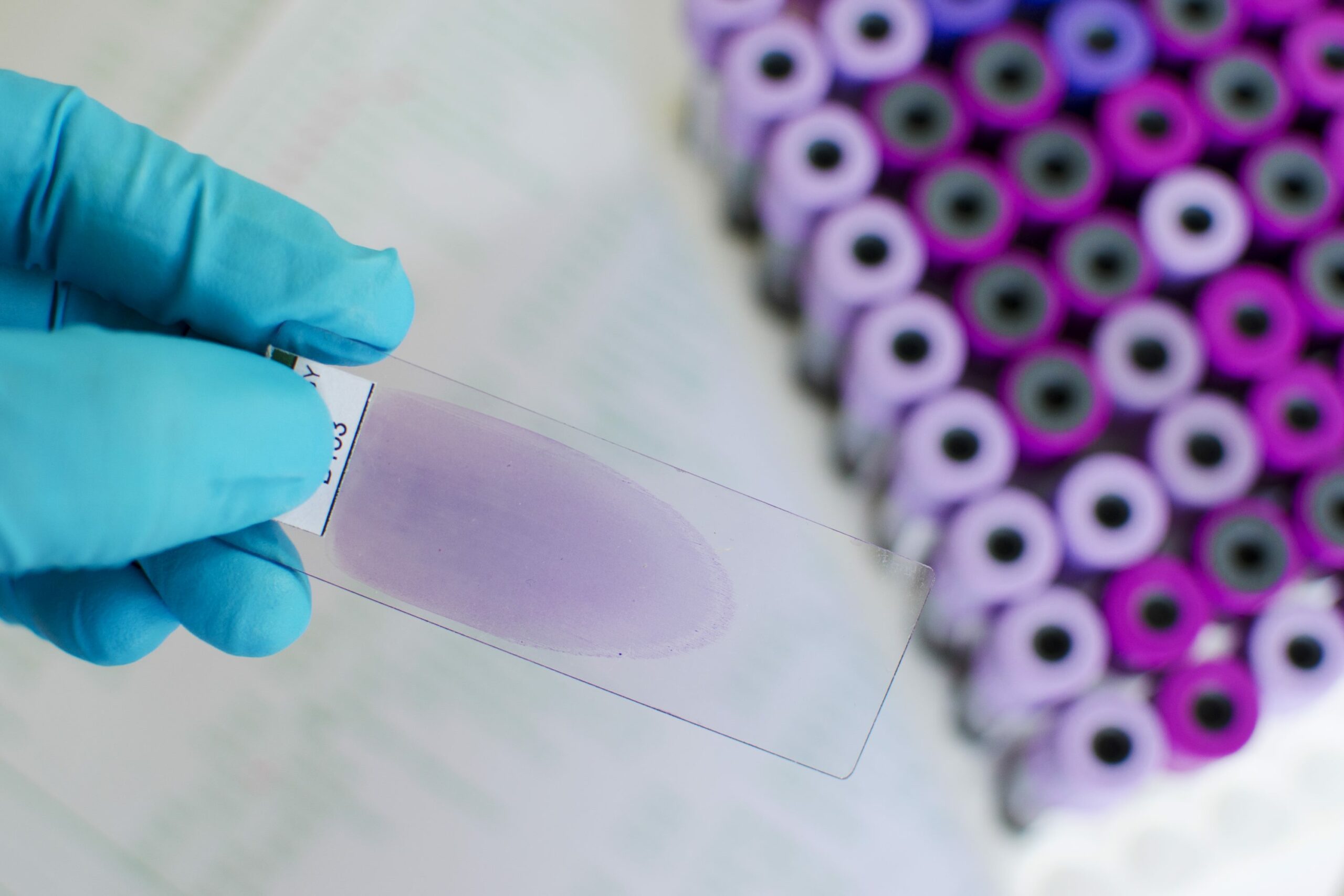 a gloved had holds a slide containing a purple sample in the foreground, a collection of purple vials in the background