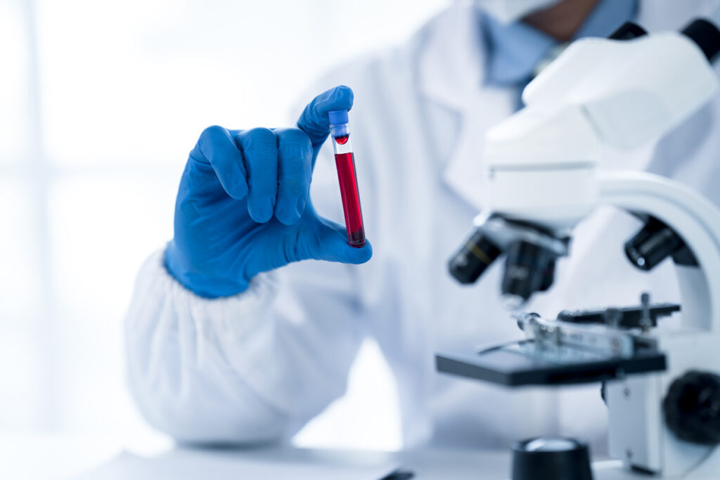 Doctor taking a blood sample tube from a rack