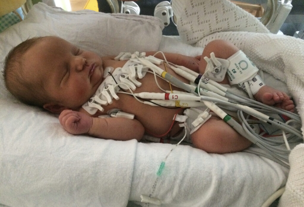 Henry as a newborn baby in hospital attached to heart monitors