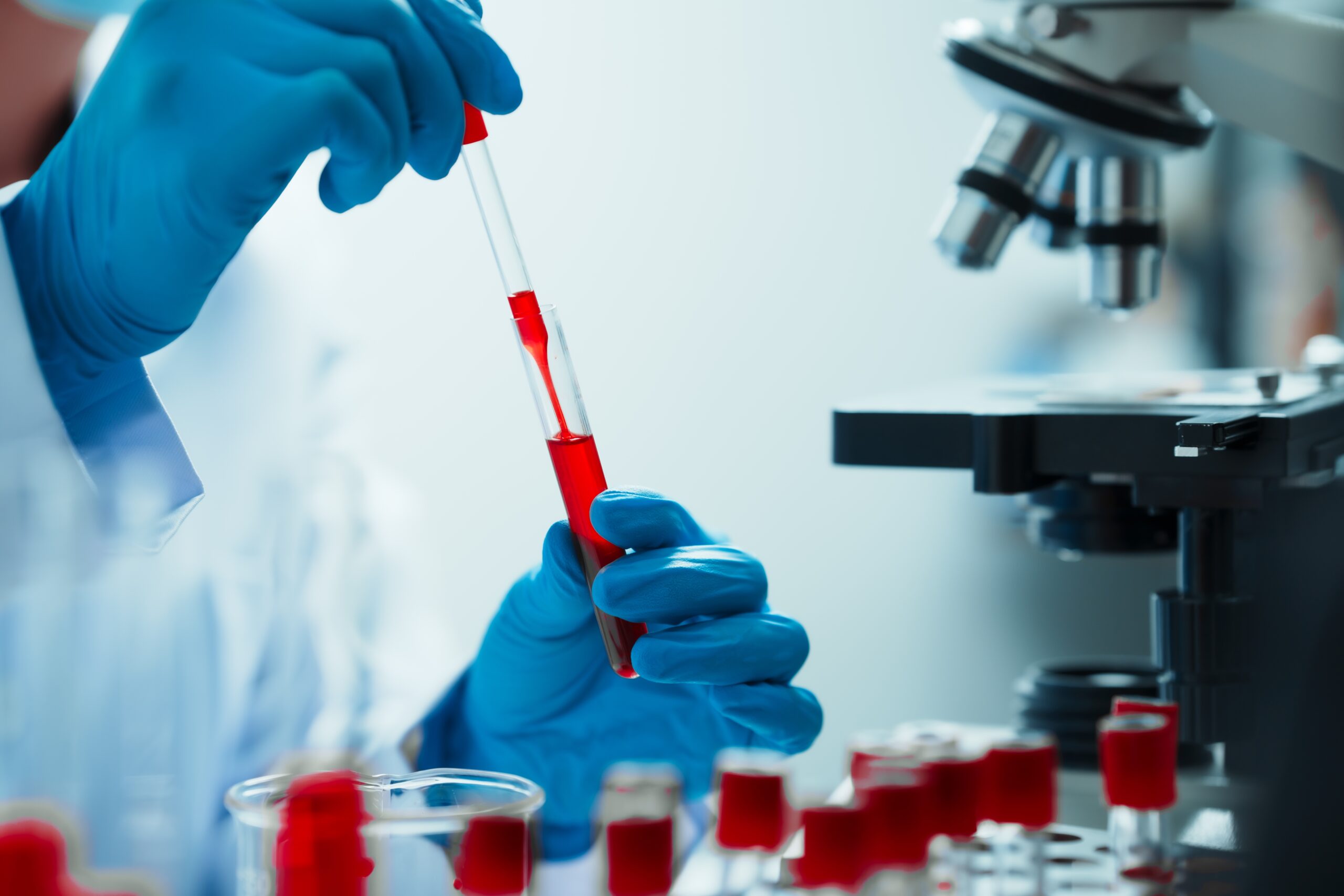 Close up of scientist's hands in a lab performing blood sample analysis