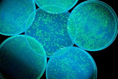 Petri dishes with bacteria on
