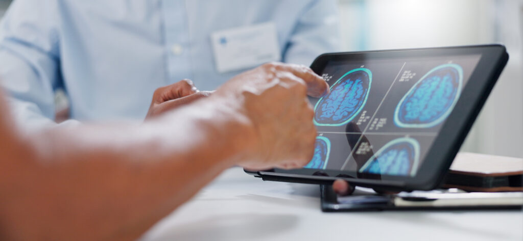Close up of a doctor's hands pointing at an image of a brain scan